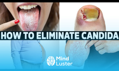 NEVER Get Candida Again