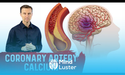 How to Read a Coronary Artery Calcium CAC Score