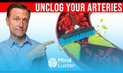 The 1 Best Remedy to Clean Plaque From Your Arteries