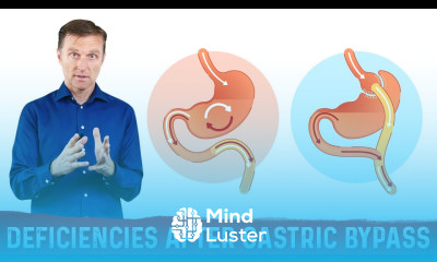 Nutritional Deficiencies after Weight Loss Surgery Gastric Bypass Bariatric Surgery – Dr Berg