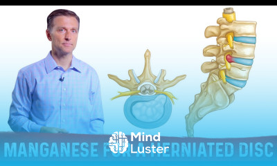 Take Manganese for Herniated Disc Strengthening Ligaments – Dr Berg