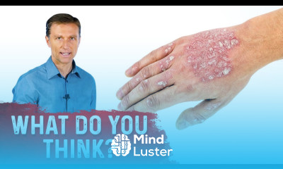 What is Psoriasis and Is Psoriasis Contagious Explained by Dr Berg