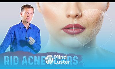 Best Way to Rid Acne Scars