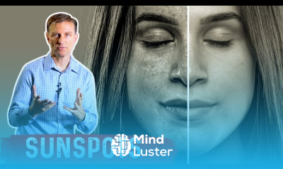 How to Get Rid of Sunspots on Your Skin