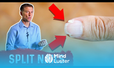 What s Lacking With Split Nails