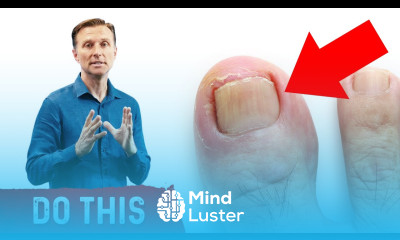 The Causes of Ingrown Toenails