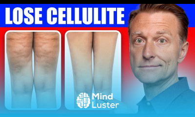Get Rid of Cellulite for Good Dr Berg s Better Way to Lose Flabby Fat