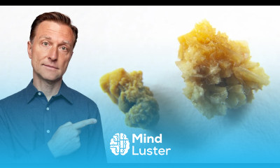 The Deeper Cause of Kidney Stones You ve Never Heard About