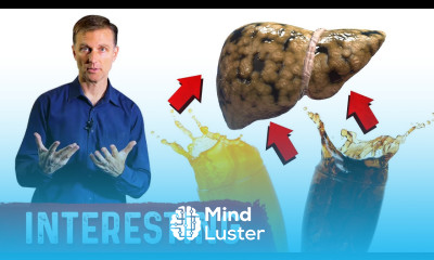 Soft Drinks and Fatty Liver Disease Interesting