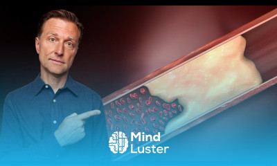 The REAL Reason Why Your Arteries are Calcifying and Turning into Bone