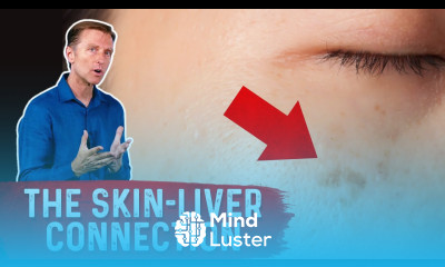 9 Signs of Toxin Build up in the Liver