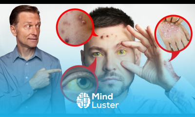 15 Things Your SKIN Tells You about Your LIVER Dr Berg