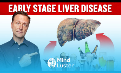 How Much Alcohol Would You Have to Drink Before Liver Damage