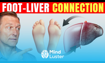 How to Use Your Feet to Diagnose Liver Problems—Dr Berg Explains