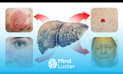 15 SKIN Signs that Reveal Your Liver is in Trouble