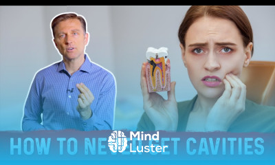 How to Never Get Dental Cavities Decay – Permanent Solution by Dr Berg