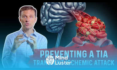How To Prevent TIA Transient Ischemic Attack Mini Stroke – Dr Berg