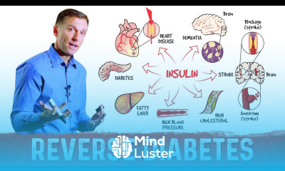How to Reverse Damage from Diabetes – Dr Berg on Reversing Diabetes