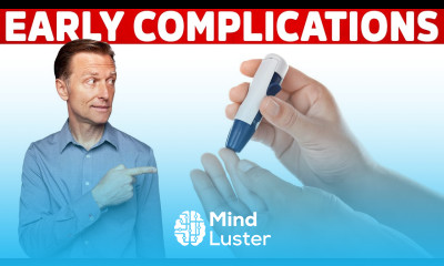 The First Complication of Diabetes – Dr Berg on Prediabetes Symptoms