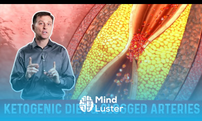 Is Keto Dangerous High Fat Ketogenic Diet Clogged Arteries – Dr Berg