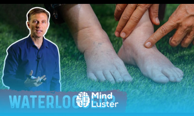 Fluid Retention On Keto Diet Dr Berg