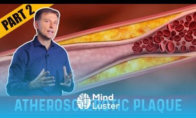 What Is Atherosclerosis Plaque – Dr Berg on Cholesterol Levels Part 2