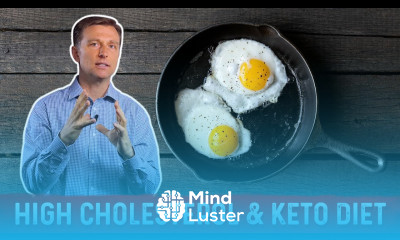 High Cholesterol on a Ketogenic diet – Dr Berg on Keto and Cholesterol