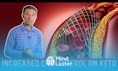 Keto And Cholesterol Why LDL Can Increase on Low Carb Diet – Dr Berg