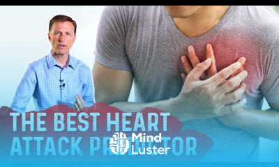 The Best Heart Attack Predictor – Coronary Artery Calcium CAC Score – Dr Berg
