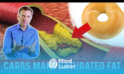 Dangerous Cholesterol Is Coming From Carbs Not Fat – Dr Berg On Cholesterol Causes Saturated Fat