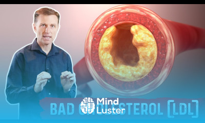 Bad Cholesterol LDL is NOT Cholesterol and Is NOT Bad – Dr Berg