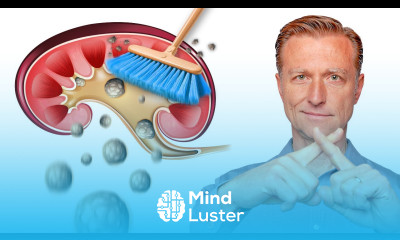 Clean Out Your Kidneys of Oxalates and Stones Dr Berg