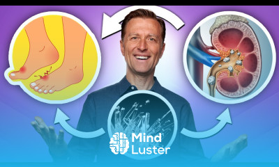 Oxalates Gout and Kidney Stones