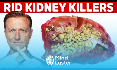 Clean Your Kidneys of Uric Acid and Oxalates