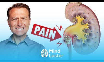 The Most PAINFUL Thing is a Kidney Stone Dr Berg