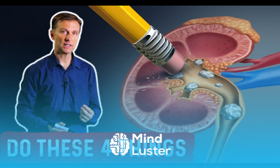 Preventing High Oxalate Kidney Stones