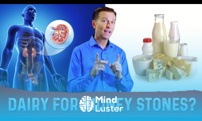 Should You Eat Dairy Calcium With Kidney Stones Food For Kidney Stones – Dr Berg