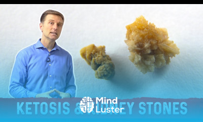 Ketosis and Kidney Stone Prevention – Dr Berg