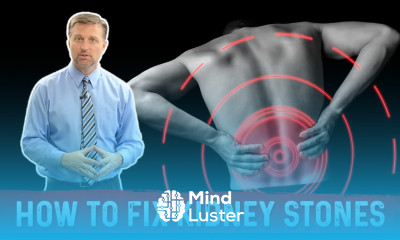 What causes Kidney Stones It s Treatment by Dr Berg