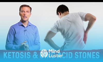 Relation Between Ketosis Uric Acid Stones – Dr Berg on Keto Kidney Stones