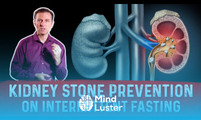 How to Prevent Kidney Stones on Intermittent Fasting if you are susceptible – Dr Berg