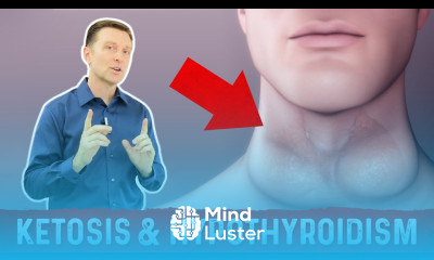 Does Ketosis Cause Hypothyroidism – Dr Berg