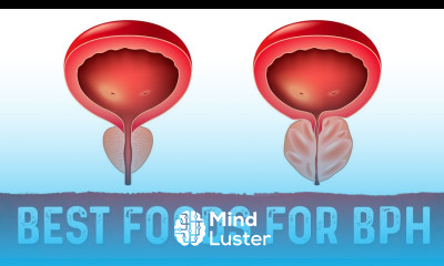 Best Foods For Benign Prostatic Hyperplasia BPH – Dr Berg