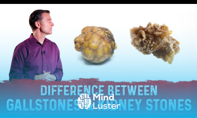 The Big Difference Between Gallstones Kidney Stones – Dr Berg
