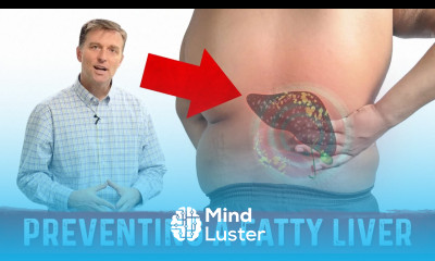 How to Prevent Fatty Liver When You Lose Weight – Dr Berg
