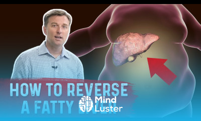 How to Reverse a Fatty Liver Dr Berg