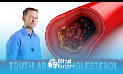 The Truth About Cholesterol – LDL Cholesterol HDL Cholesterol – Dr Berg