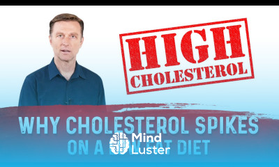 Why Cholesterol Levels Spike on Low Fat Cholesterol Diet – Dr Berg