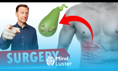 Gallbladder Surgery Removal WATCH THIS