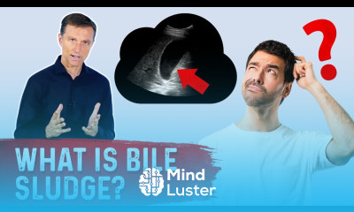 Bile Sludge is a Pre Gallstone Condition – Bile Sludge Treatment Covered by Dr Berg